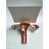 Medical Human Uterus Ovary Pathology Portable Simulation Female Reproductive Model Teaching Anatomy labs Researches