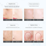 Portable Cool + Hot Facial Electroporation Cryotherapy RF Beauty hine Anti-aging Rejuvenation Skin Coog Tight Device