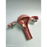 Medical Human Uterus Ovary Pathology Portable Simulation Female Reproductive Model Teaching Anatomy labs Researches