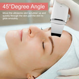Ultrasonic Skin Scrubber Limpieza Facial Pore Spatula EMS Lifting Blackhead Removal Ultrasonic Face Peeling Ultrassonico
