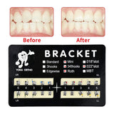200Pcs Teeth Model Mini Brackets Roth 022 Slot Bondable With Hook On 345