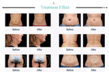 New Bestselg 80K Cavitation RF Ultrasonic Vacuum Weight Loss Body Slimming Beauty hine