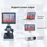 Digital Microscope Zoom Nailfold Capillary Microcirculation Detector Blood Microcirculation Analyzer with 7/8/9" Digital Screen
