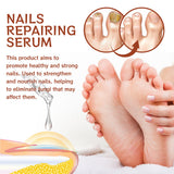 20ml Cuticle Nutrient Nourish Repair Damaged Nail Care Nutrition Oil Treatment Moisturizes Strengthen Bright for Nails