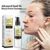 Hyaluronic Face Moisturizer snail Cream Anti-Wrinkle Aging Moisturizing Shrink Pores Whitening Smooth Skin Care