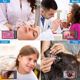 Digital Otoscope with 7-Inch Screen, Camera, Visual Ear Scoop Supports Photo Snapshots and Video Recording (32G)