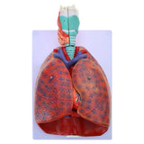 Lung Anatomy Model for Educational Training Aid, Anatomical Heart Lung Throat Model Shows Details of Lung Trachea System