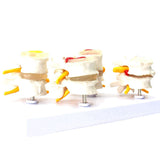 1 Pcs Skeleton Spine Lumbar Disc Herniation Teaching Model &amp; 1 Pcs Human Anatomy Skeleton Spine Vertebral Model