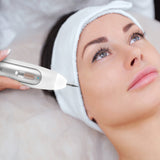 Portable Wireless Laser Freckle Removal Machine Skin Mole Dark Spot Remover for Wart Tag Tattoo Removal Pen Salon Face Beauty