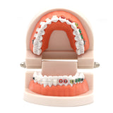 1pc Dental Orthodontic Treatment Model Typodont With Ortho Metal Ceramic Bracket Arch Wire Orthodontic Toothed Denture Model