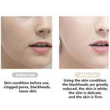 Blackhead Remover Ultrasonic Skin Scrubber Facial Cleaner Ion Acne Peeling Shovel Cleaner Facial Massager Tool Face Lift Machine