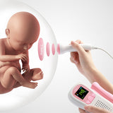 Handheld Fetal Doppler Prenatal Baby Heartbeat Monitor Heart Rate Detector Household Sonar Doppler Pregnant Women
