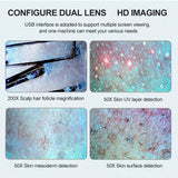 Professional Skin Hair Detector Scalp Hair Follicle Moisture/Skin Pores Pigment Magnifying Analyzer Skin Pigment Tester 11Inch
