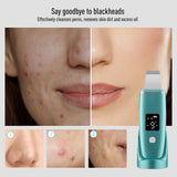 Ultrasonic Cleaner Skin Scrubber High Frequency Vibrator Skin Care Blackhead Remover Pore Deep Cleanse Skin Dirts Peeling Shovel
