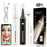 Visual Ultrasonic Dental Scaler Set Electric Tooth Cleaning Machine Tartar Calculus Removal Eliminator with LED Light