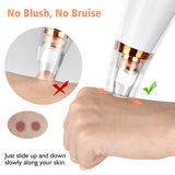 Facial Blackhead Remover Nose Pore Cleaner Vacuum Suction Pimple Black Dot Removal Facial Cleaning Beauty Tools Face Skin Care