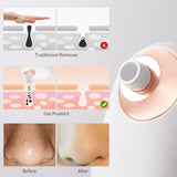 Acne Blackhead Remover LCD Display Facial Cleanser Vacuum Suction USB Charging Skin Care Pore Extractor Machine Electric Tool