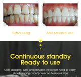 Household Teeth Cleaning Tartar Cleaning Calculus Tartar Tooth Stain Portable Electric Tooth Cleaner Calculus Remover