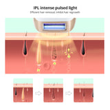 999,999 Flashes IPL Laser Hair Removal FOR Full Body Face Back Armpits Bikini Lasting Hair Remover Laser Epilator Dropshipping
