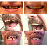 Temporary Dental care Oral hygiene False Fake perfect smile whitening Teeth Dentures Dents Fix Gap Front Lost veneers Braces