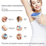 M3 Laser Hair Removal Equipment Ipl Laser Hair Removal 500,000 Flashes with 3 Functional Lamp