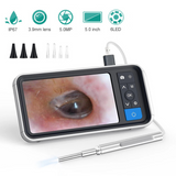 Digital Otoscope with 5 Inches Screen 3.9mm 1080P HD Ear Scope Endoscope Ear Cleaner With 2500mAh Rechargeable Battery