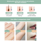 999999 Flash Photoepilator Whole Body IPL Hair Removal Laser Epilator For Women Painless Threading Laser Hair Removal Machine