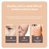 Multifunction Facial Mesotherapy LED Light Therapy Wrinkle Removal EMS Skin Rejuvenation Tightening RF Lifting Beauty Device