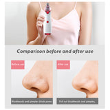 Skin Care Tools Blackhead Remover Face Deep Nose Cleaner T Zone Pore Acne Pimple Removal Vacuum Suction Facial Diamond Beauty