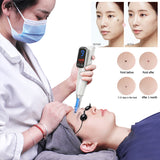Professional Laser Picosecond Pen Freckle Tattoo Removal Mole Dark Spot Eyebrow Pigment Touch screen Laser Acne Treatment Machin