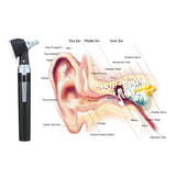 Carevas Fiber Optic LED Otoscope 3X True View Full Spectrum Home Physician Ear Care Diagnostic Set with 8 Tips for Adult Child