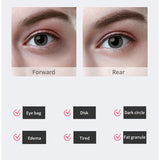 2 In 1 Visible Blackhead Remover WiFi Camera Vacuum Suction Facial Pore Cleaner Anti-acne Pimple Vibration Eye Care Machine