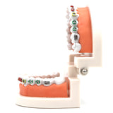 Dental Orthodontic Treatment Model With Ceramic Bracket Arch Wire Ortho Metal Orthodontic Toothed Denture Model