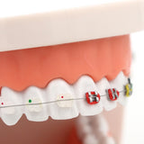 1pc Dental Orthodontic Treatment Model Typodont With Ortho Metal Ceramic Bracket Arch Wire Orthodontic Toothed Denture Model