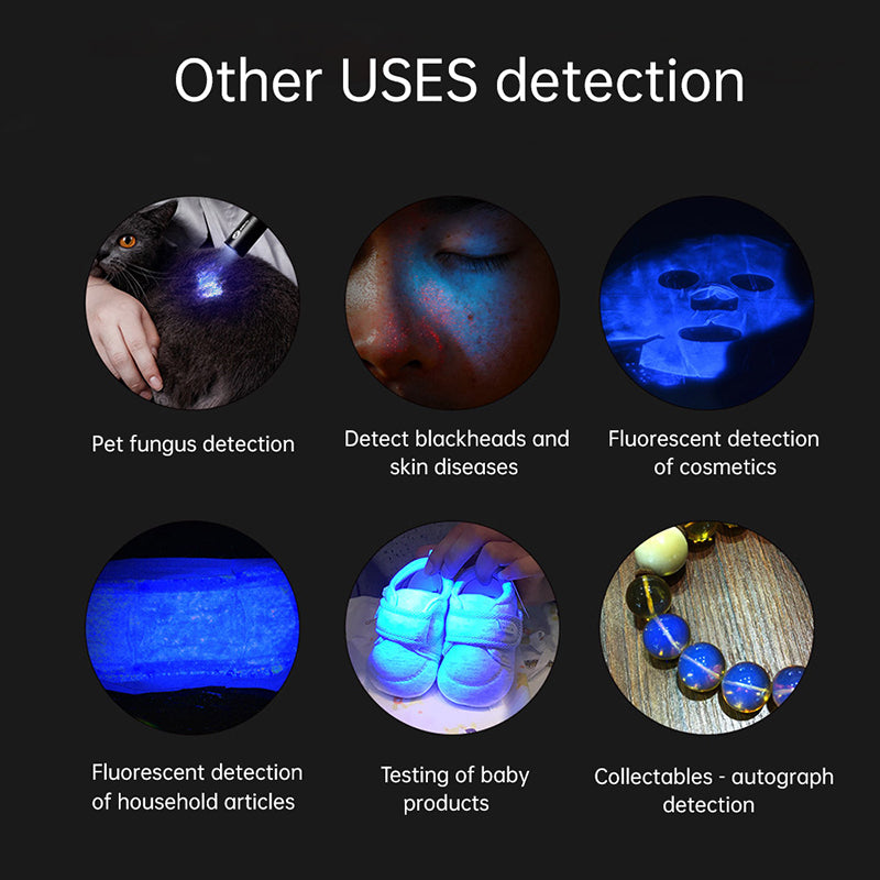 NEW Wood‘s Lamp Skin Fungus Detector Phosphor Vitiligo Pityriasis Versicolor Melasma Detector Woods Light Examination