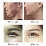 2021 RF Fractional Microneedling Radio Frequency Face Lift Skin Tightening Wrinkle Remover Micro-current Anti-Aging Skin Firming