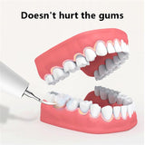 Electric Oral Irrigator Dental Calculus Remover Ultrasonic Whitening Teeth Cleaner Tooth Stain Removal Household Dental Scaler