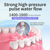 Electric Oral Irrigator Water Flosser 300Ml Dental Tooth Cleaner Usb Charge Household Toothpick Calculus Tartar Stains Remover