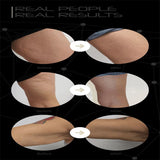 3In 1 Ultrasound EMS Body Slimming Massager RF Weight Loss Machine Skin Lift Tighten Firm Fat Burning Iron Reduce Stretch Marks