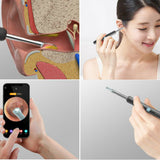 Ear Wax Removal Ear Cleaner Ear Wax Removal Kit Wireless Ear Wax Remover Otoscope With Endoscope Ear Wax Removal Tool