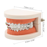 1pc Dental Orthodontic Treatment Model Typodont With Ortho Metal Ceramic Bracket Arch Wire Orthodontic Toothed Denture Model