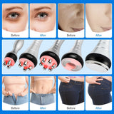 5-IN-1 Home Use Multifunction RF &amp; 40K Cavitation Body Slimming Liposuction Machine Weight Loss Anti Cellulite Wrinkle Removal