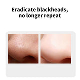 Blackhead Remover Electric Acne Cleaner Blackhead Black Point Vacuum Cleaner Tool Black Spots Pore Cleaner Clean Skin Machine