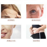 110V/220V Radar Line Engraving Beauty Instrument V-Type Face Firming Lifting Anti-Wrinkle Facial Beauty Machine