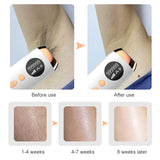 IPL Hair Removal Laser Epilator for Women Portable 999999 Flash Permanent Painless Whole Body Photoepilator MINI Laser Depilador