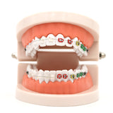 Dental Orthodontic Treatment Model With Ceramic Bracket Arch Wire Ortho Metal Orthodontic Toothed Denture Model