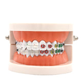 1pc Dental Orthodontic Treatment Model Typodont With Ortho Metal Ceramic Bracket Arch Wire Orthodontic Toothed Denture Model
