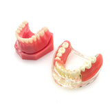Dental Implant Restoration Teeth Model Removable Bridge Denture Teaching research model