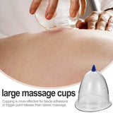 1pc Cupping Therapy Device Large Back Neck Body Vacuum Cupping Tool
