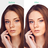 Beauty Equipment Laser Freckle Remove Moles Beauty Equipment Facial Beauty Tools